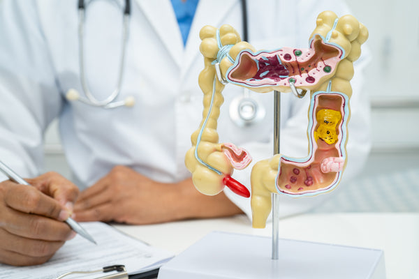 Consumo de alcohol: Cómo afecta a nuestra flora intestinal